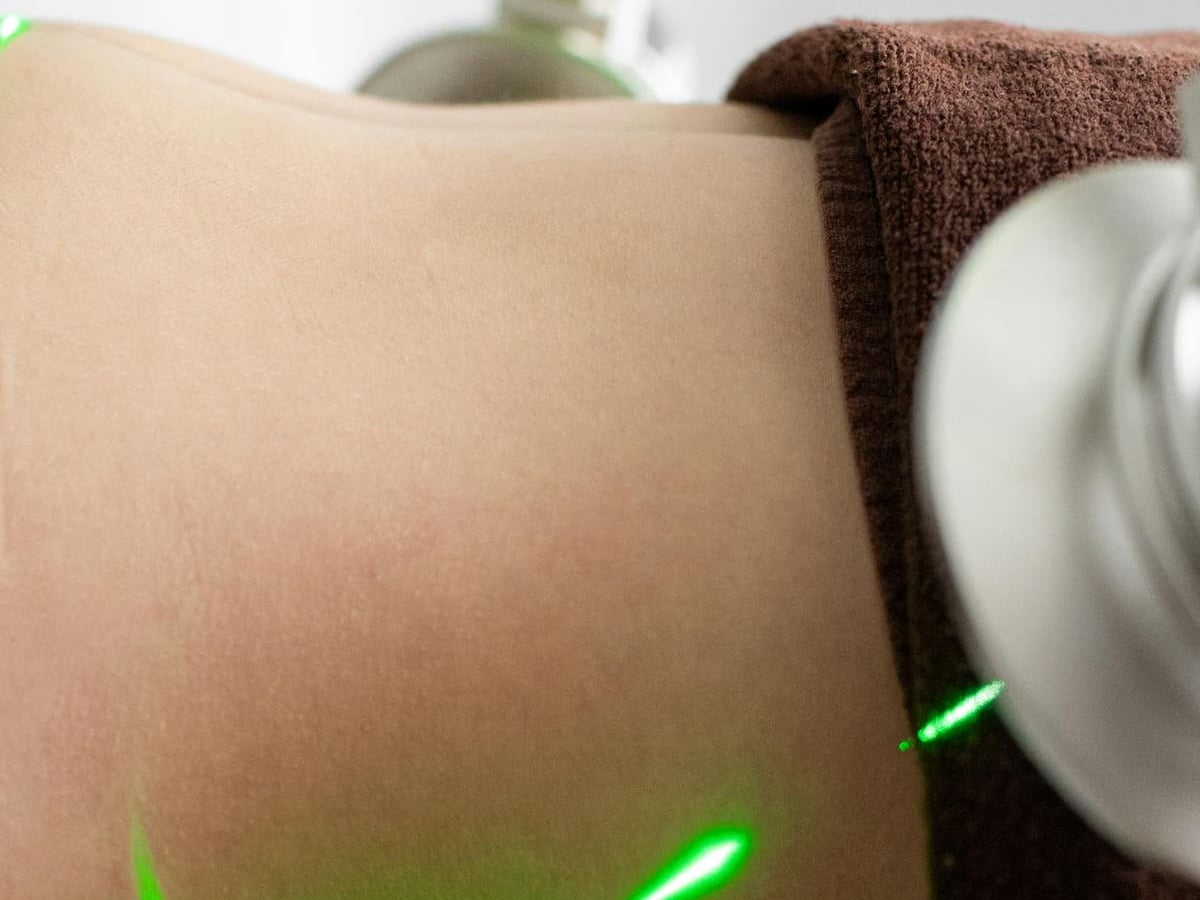 Liposucción con el Dr. Pablo Contreras en Clínica WLK Providencia