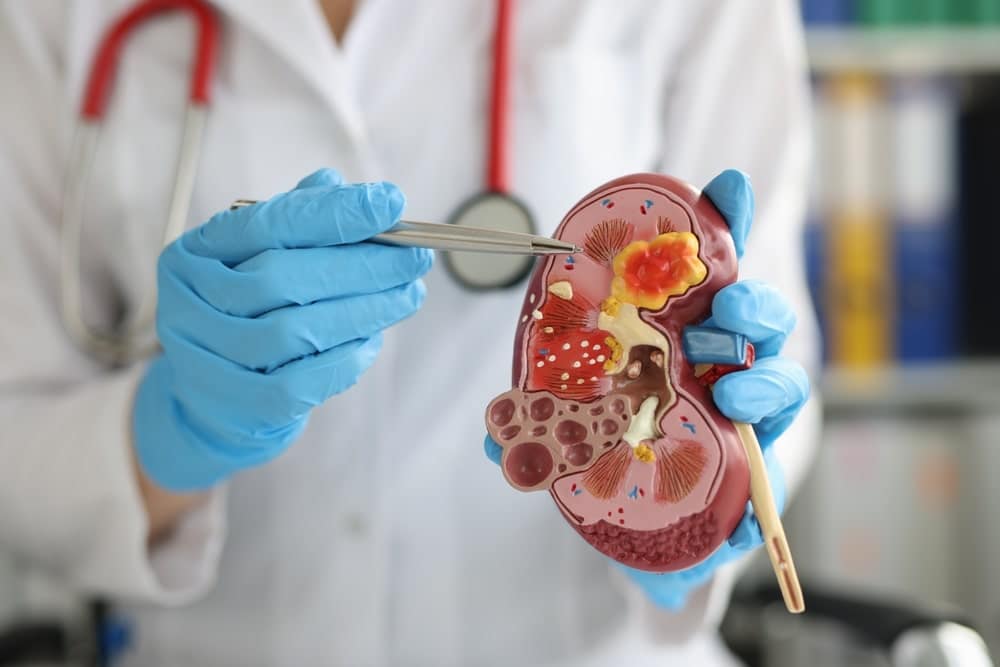 Procedimiento urológico ambulatorio en Clínica WLK